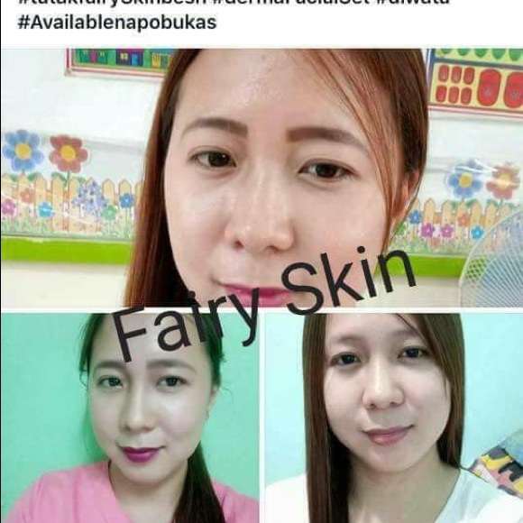 Fairy Skin Derma Facial Set Rejuvenating Whitening - Picture 6 of 8